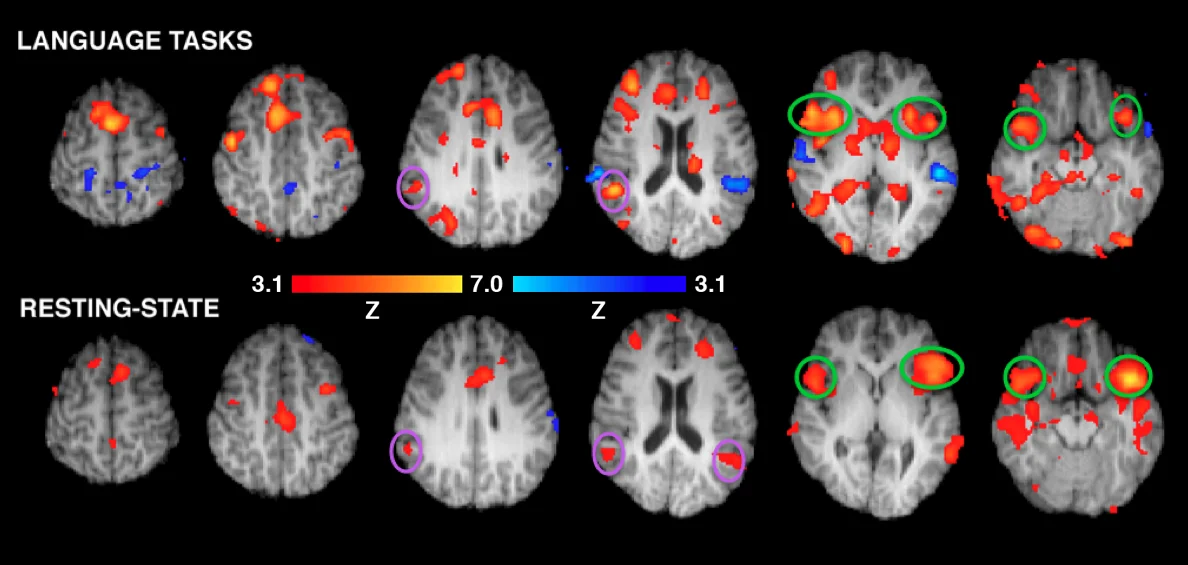 fMRI-brain-scans-neuromarketing